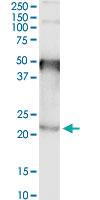 Anti-TMEM86B Rabbit Polyclonal Antibody