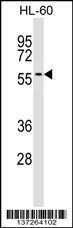 Anti-IFRD2 Rabbit Polyclonal Antibody (HRP (Horseradish Peroxidase))