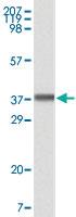 Anti-BLK Monoclonal Antibody [clone: 9D10B7H6, 9D10A8F8]