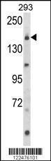 Anti-Munc13-2 Rabbit Polyclonal Antibody (HRP (Horseradish Peroxidase))