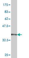 Anti-BTG2 Mouse Monoclonal Antibody [clone: 1B8]