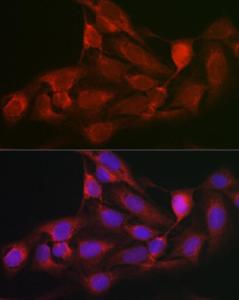 Immunofluorescence analysis of U2OS cells using Anti-PPP1R3C Antibody (A307722) at a dilution of 1:50 (40X lens). DAPI was used to stain the cell nuclei (blue)