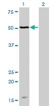 Anti-MAGOH Mouse Monoclonal Antibody [clone: 4H8]