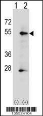 Anti-ALPP Rabbit Polyclonal Antibody (AP (Alkaline Phosphatase))