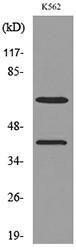 Western blot analysis of lysate from K562 cells using Anti-CYP11A1 Antibody