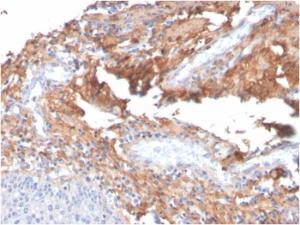 Immunohistochemical analysis of formalin-fixed, paraffin-embedded human tonsil using Anti-Fibronectin Antibody [C6F10]