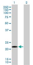 Anti-CLEC1B Mouse Polyclonal Antibody