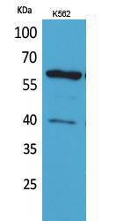 Western blot analysis of K562 cells using Anti-CYP11A1 Antibody