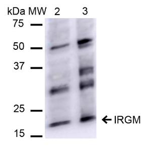 Western blot analysis of human HeLa and HEK293Trap cell lysates showing detection of ~20.1 kDa IRGM protein using Anti-IRGM Antibody (A304839) at 1:1,000 for 2 hours at room temperature