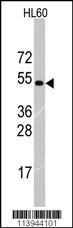 Anti-TRIM69 Rabbit Polyclonal Antibody