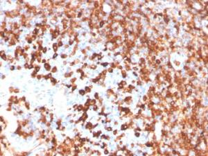 Immunohistochemical analysis of formalin-fixed, paraffin-embedded human tonsil using Anti-CD79a Antibody [IGA/3939R]