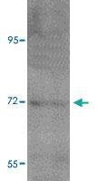 Anti-ANO1 Rabbit Polyclonal Antibody