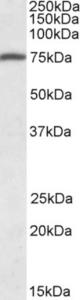 EB09539 (1 µg/ml) staining of Human Peripheral Blood Mononucleocytes lysate (35 µg protein in RIPA buffer). Primary incubation was 1 hour. Detected by chemiluminescence.