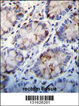 Anti-C1QC Rabbit Polyclonal Antibody (HRP (Horseradish Peroxidase))