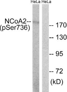 Western blot analysis of lysates from HeLa cells treated with TSA 400 nM 24 h using Anti-NCoA2 (phospho Ser736) Antibody. The right hand lane represents a negative control, where the Antibody is blocked by the immunising peptide