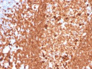 Immunohistochemical analysis of formalin-fixed, paraffin-embedded human tonsil using Anti-CD79a Antibody [IGA/3939R]