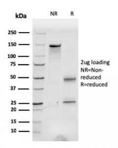 SDS-PAGE analysis of Anti-Fibronectin Antibody [C6F10] under non-reduced and reduced conditions; showing intact IgG and intact heavy and light chains, respectively. SDS-PAGE analysis confirms the integrity and purity of the antibody