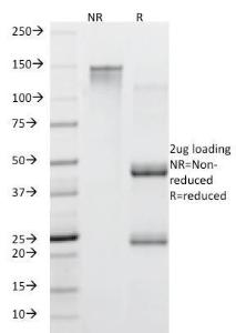 SDS-PAGE analysis of Anti-Mucin 5AC Antibody [45M1] under non-reduced and reduced conditions; showing intact IgG and intact heavy and light chains, respectively. SDS-PAGE analysis confirms the integrity and purity of the Antibody