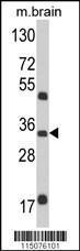 Anti-M6PR Rabbit Polyclonal Antibody