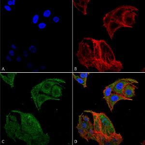 Immunocytochemistry/Immunofluorescence analysis of human colon carcinoma cell line (RKO), fixed in 4% formaldehyde for 15 min at room temperature, using Anti-IRGM Antibody (A304839), at 1:100 for 60 minutes at room temperature