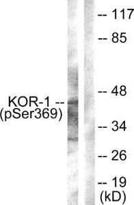 Western blot analysis of lysates from NIH/3T3 cells using Anti-KOR-1 (phospho Ser369) Antibody. The right hand lane represents a negative control, where the antibody is blocked by the immunising peptide.