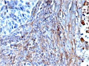 Immunohistochemical analysis of formalin-fixed, paraffin-embedded human lung using Anti-Fibronectin Antibody [FN1/3568]