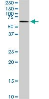 Anti-MAK Mouse Monoclonal Antibody [clone: 3E5]