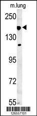 Anti-IFT172 Rabbit Polyclonal Antibody (HRP (Horseradish Peroxidase))