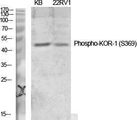 Western blot analysis of various cells using Anti-KOR-1 (phospho Ser369) Antibody