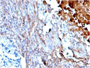 Immunohistochemical analysis of formalin-fixed, paraffin-embedded human lung using Anti-Fibronectin Antibody [FN1/3568]