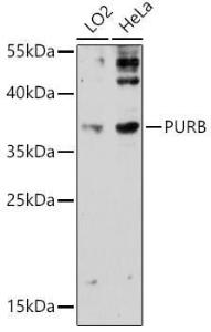 Anti-Pur B Rabbit Polyclonal Antibody