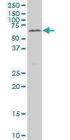 Anti-MAK Mouse Monoclonal Antibody [clone: 3E5]