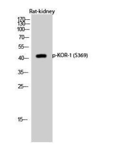 Western blot analysis of rat kidney cells using Anti-KOR-1 (phospho Ser369) Antibody