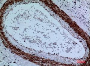 Immunohistochemical analysis of paraffin-embedded human brain using Anti-CYP11A1 Antibody