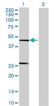 Anti-TASP1 Mouse Polyclonal Antibody