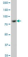 Anti-RPS6KA6 Mouse Monoclonal Antibody [clone: 3E2]