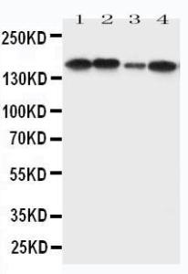 Anti-ROCK2 Rabbit Polyclonal Antibody