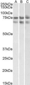 Anti-GNL3 Antibody (A82804) (2µg/ml) staining of HeLa (A)HepG2 (B) and K562 (C) nuclear lysates (35µg protein in RIPA buffer). Primary incubation was 1 hour. Detected by chemiluminescence.