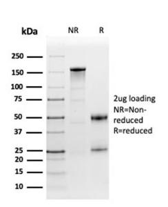 SDS-PAGE analysis of Anti-Fibronectin Antibody [FN1/3568] under non-reduced and reduced conditions; showing intact IgG and intact heavy and light chains, respectively. SDS-PAGE analysis confirms the integrity and purity of the antibody