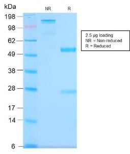 Anti-MUC1 antibody