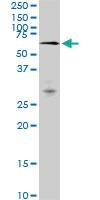 Anti-MAK Mouse Monoclonal Antibody [clone: 3E5]