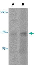 Anti-ANO2 Rabbit Polyclonal Antibody