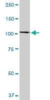 Anti-RABEP1 Mouse Monoclonal Antibody [clone: 3H6]