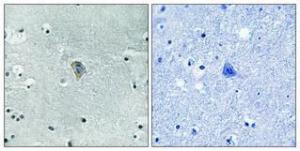 Immunohistochemical analysis of paraffin-embedded human brain using Anti-KOR-1 (phospho Ser369) Antibody 1:100 (4°C overnight). The right hand panel represents a negative control, where the antibody was pre-incubated with the immunising peptide.