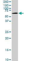 Anti-MAK Mouse Monoclonal Antibody [clone: 3E5]