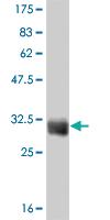 Anti-TAF11 Mouse Monoclonal Antibody [clone: 3H5]