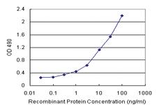 Anti-TOLLIP Antibody Pair