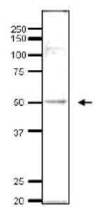 Anti-ADA2 Antibod