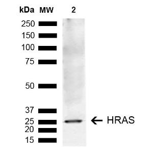 Western blot analysis of human lung carcinoma epithelial cell line (A549) lysate showing detection of ~2