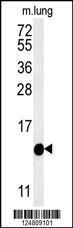 Anti-IFT20 Rabbit Polyclonal Antibody (APC (Allophycocyanin))